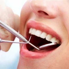 Carbs, Sugary Foods May Influence Poor Oral Health: Study