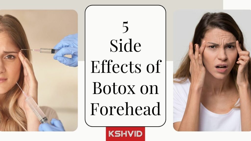 5 Common Side Effects of Botox Injections on Forehead