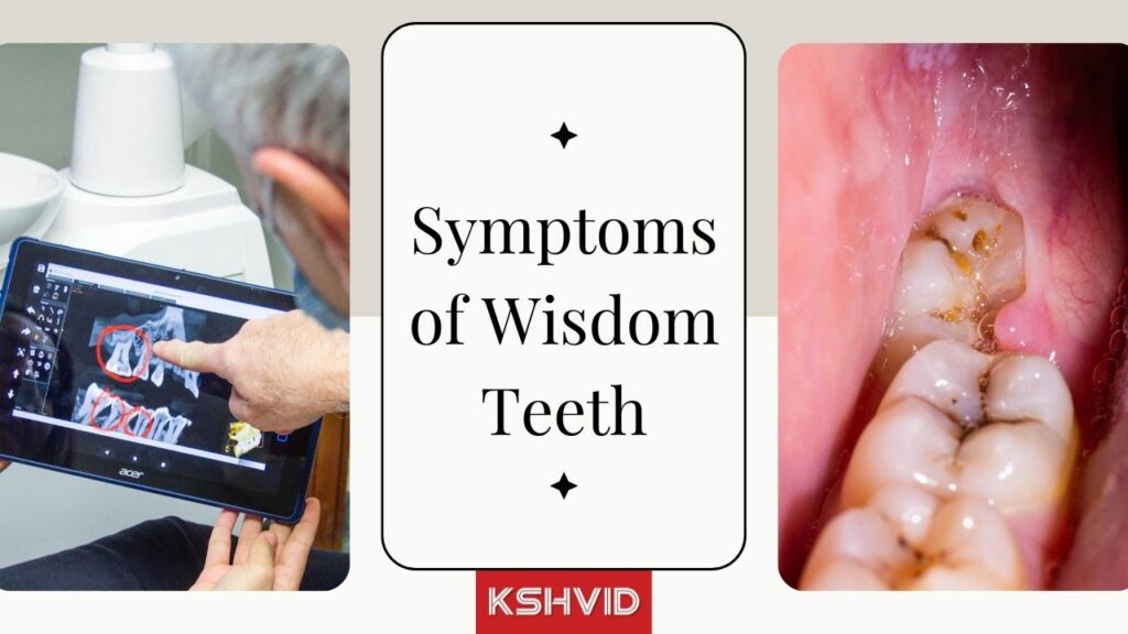 Symptoms of Wisdom Teeth, Extraction, and Removal