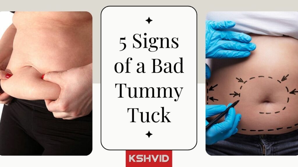 signs of a bad tummy tuck