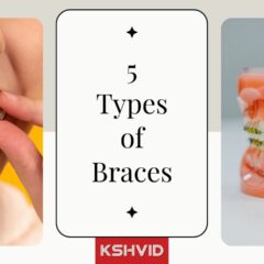 Walking Through The 5 Types Of Braces