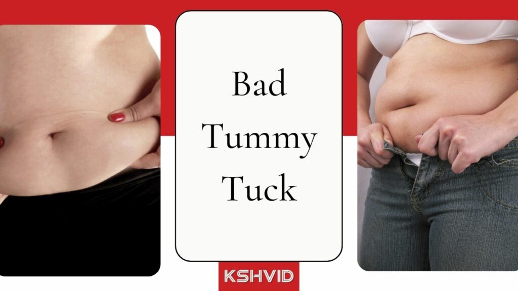 Bad Tummy Tuck Warning Signs, Complications, and Risks - kshvid