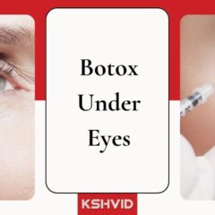 Revive Your Eyes With The Magic of Under Eye Botox
