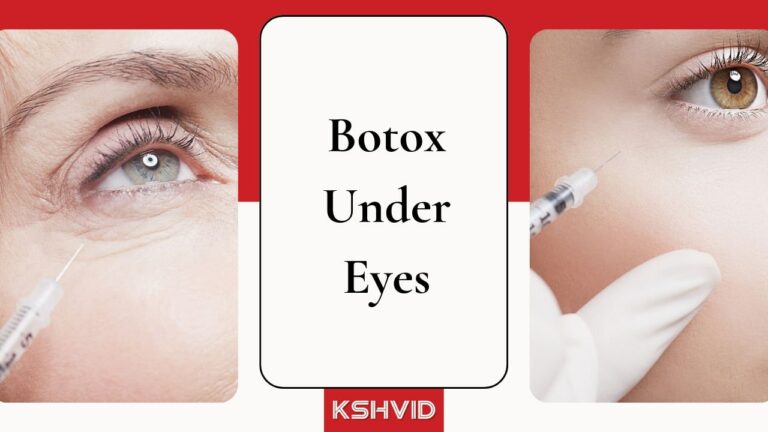 Botox Under Eyes-kshvid