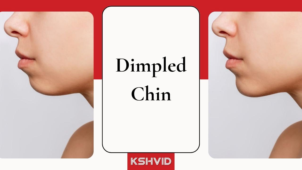 Dimpled Chin-kshvid