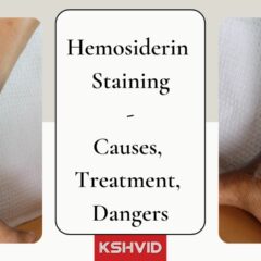 Hemosiderin Staining 101; Symptoms, Causes and Treatment