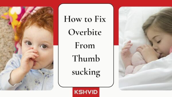 How to Fix Overbite From Thumbsucking - Solution Guide 2023 - KSHVID