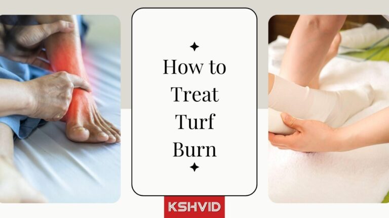 How to Treat Turf Burn - KSHVID | Turf Burn: Infection, Heal Time, Treatment, and Prevention