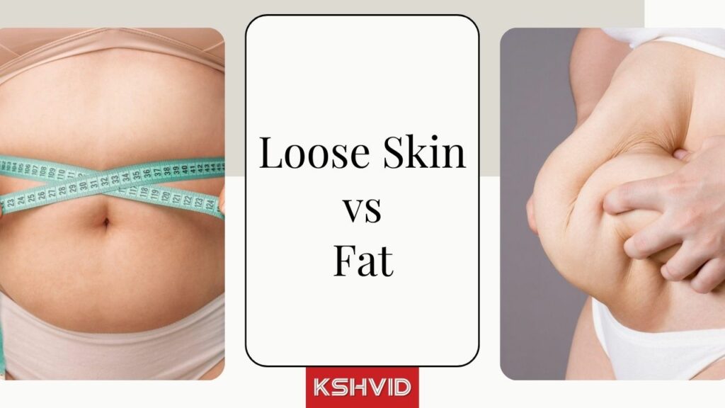 Loose Skin vs Fat - Major Differences KSHVID