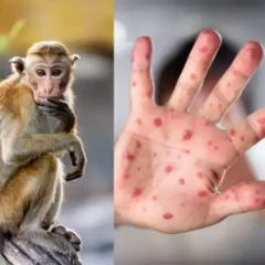 Monkeypox Threat: Cases in Britain surpass 500, Panic spreads