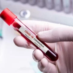 Study: Blood Test Can Help Indicate Whether A Person Is Likely To Develop Long-Term Covid