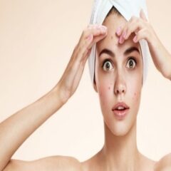 Tips To Prevent Summer Acne