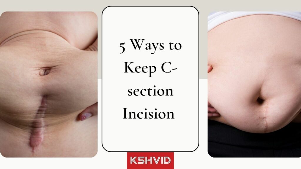 how to keep c-section incision dry when overweight