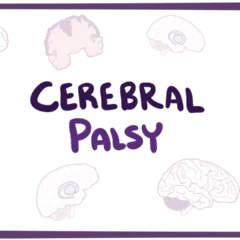 Study Finds Cerebral Palsy May Be Treatable
