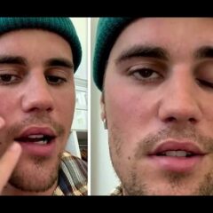 Justin Beiber Suffering Partial Face Paralysis By Serious Virus, Cancels Shows