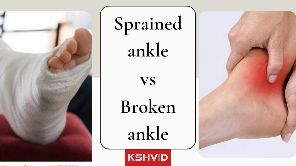sprained ankle vs broken ankle