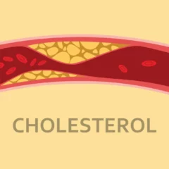 New Insights Into Genetic Causes Of High Cholesterol: Research